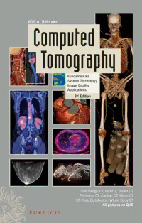 Download Computed Tomography: Fundamentals, System Technology, Image Quality, Applications PDF 